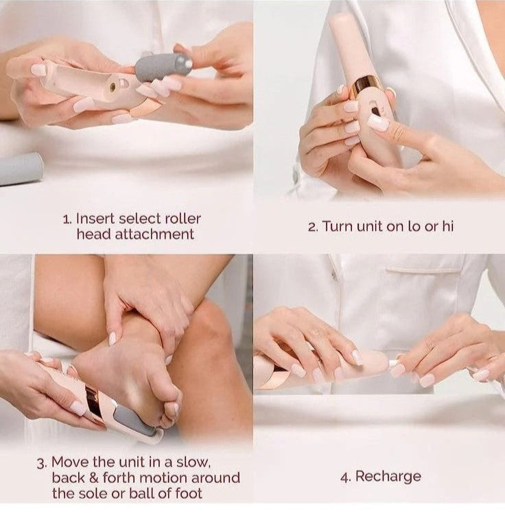 Electronic Cordless Pedicure Callus Dead Skin Remover Polishing Tool