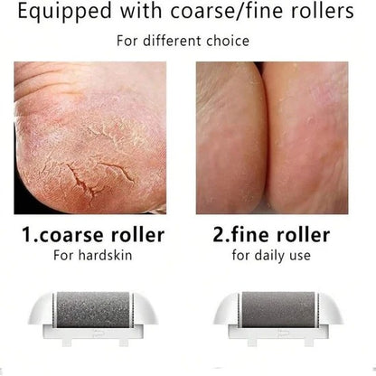 Electronic Cordless Pedicure Callus Dead Skin Remover Polishing Tool